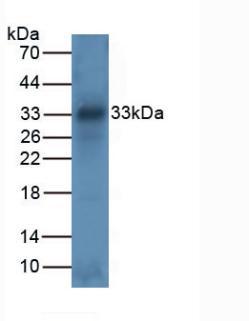 4524