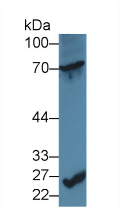 13978