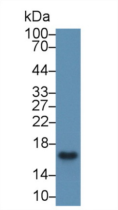 14760