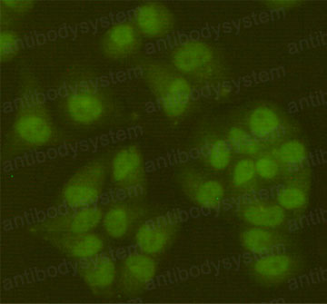 Валидация IF - AntibodySystem RHJ22902