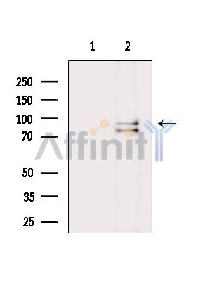 Валидация Affinity DF14956 - 11141