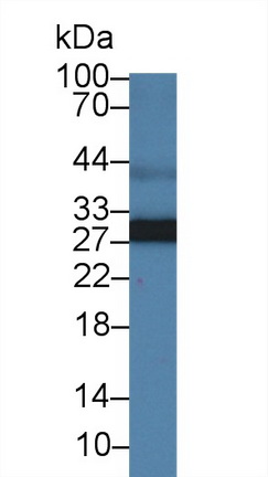 9562