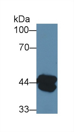14114