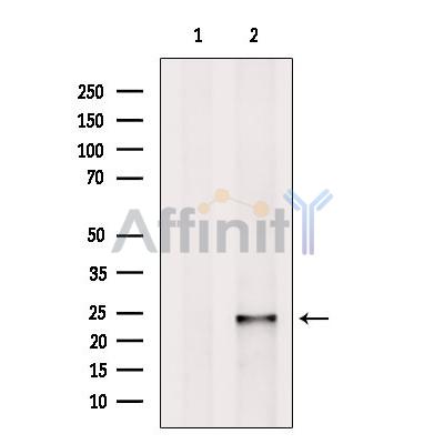 Валидация Affinity DF13290 - 8415