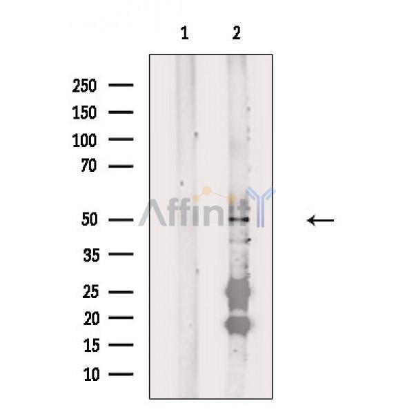 Валидация Affinity DF4061 - 15330