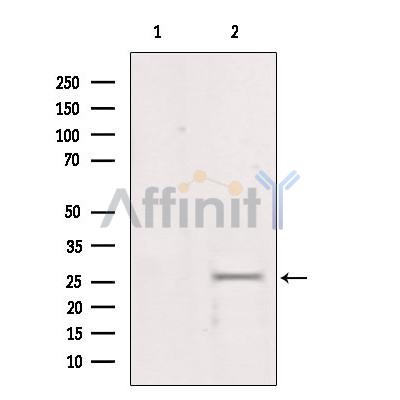 Валидация Affinity DF6420 - 17789