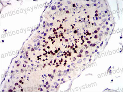 Валидация AntibodySystem RHC90504 (1160)