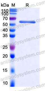 YHA04302, SDS-PAGE