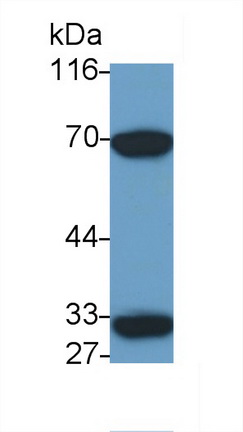 14250