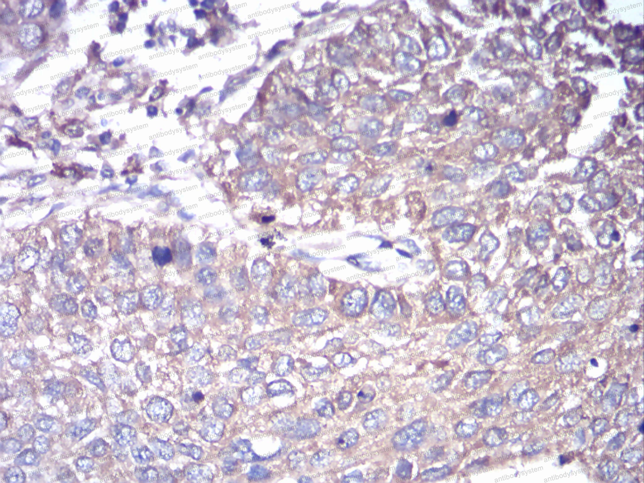 Валидация AntibodySystem RHF56801 (2573)