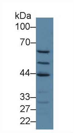13985