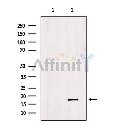 Валидация Affinity DF6178 - 17424