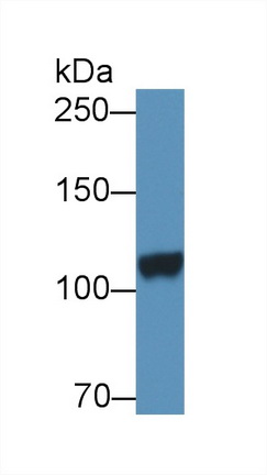 14123
