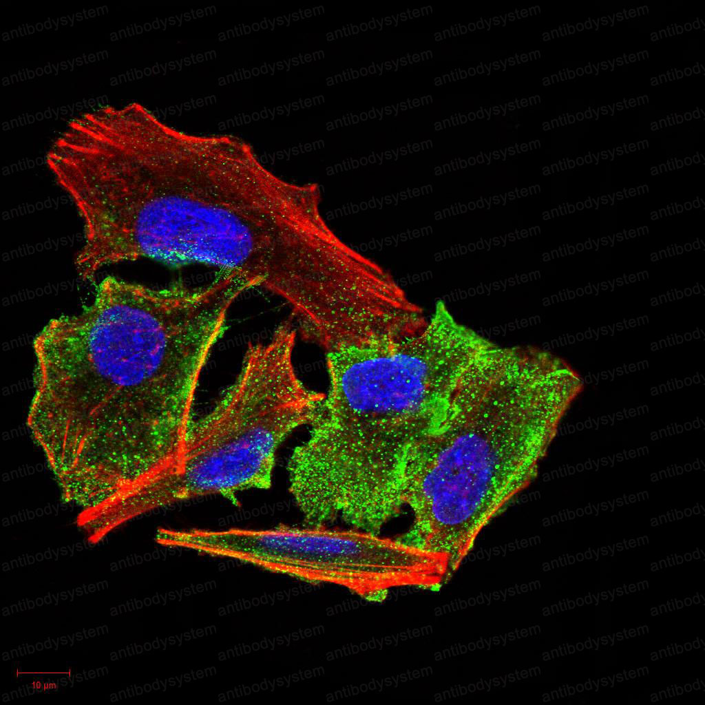 Валидация IF - AntibodySystem RHC01306 (238)