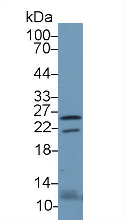 13760