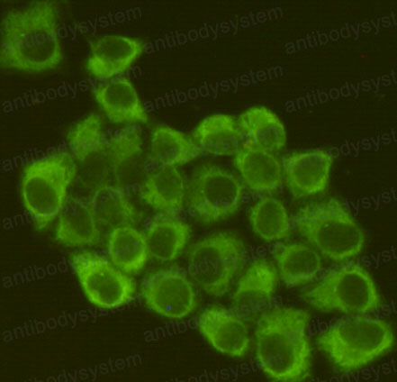 Валидация IF - AntibodySystem RHC15504