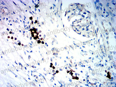 Валидация AntibodySystem RHH08902