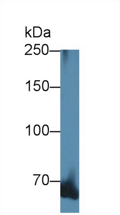 12611