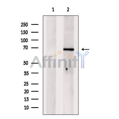 Валидация Affinity DF7015 - 18651