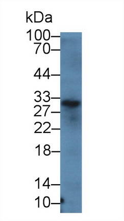 14926