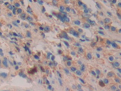 16056