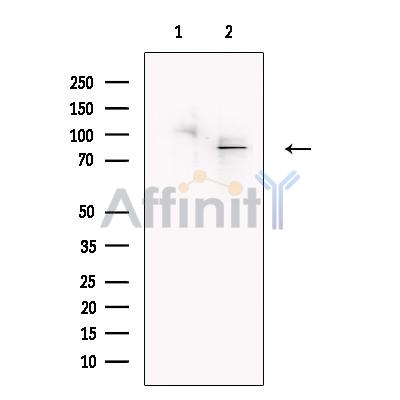 Валидация Affinity DF13604 - 9100