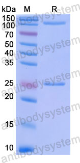 Валидация SDS-PAGE - AntibodySystem DHC80003
