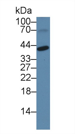 14111