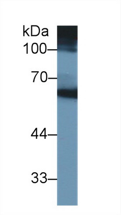 14835