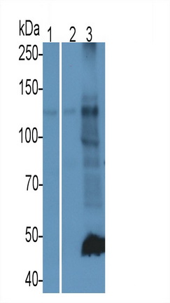19008