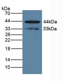 5692