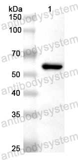 Валидация AntibodySystem PHB22201