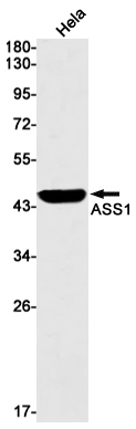 Валидация WB - AssayVector ARM1190 (192)