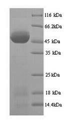 SDS-PAGE