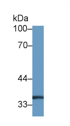 14467