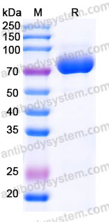 AHJ28801, SDS-PAGE