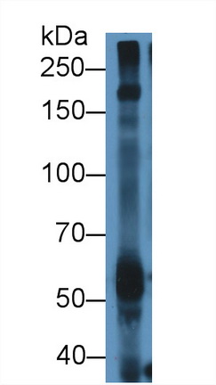 12922