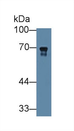 12577