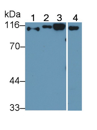 14911
