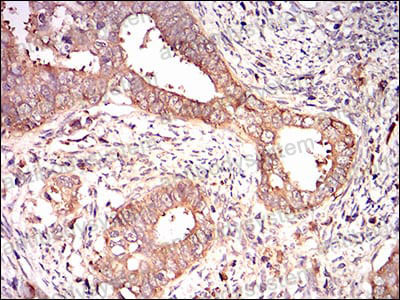 Валидация AntibodySystem RHN83803 (3901)