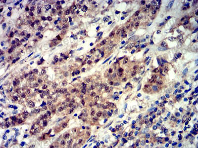 Валидация AntibodySystem RHG57906 (3000)