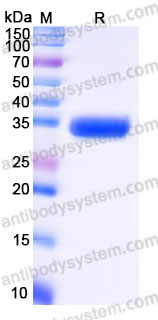 EHG52005, SDS-PAGE