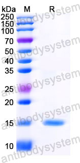 Валидация SDS-PAGE - AntibodySystem RHJ38901
