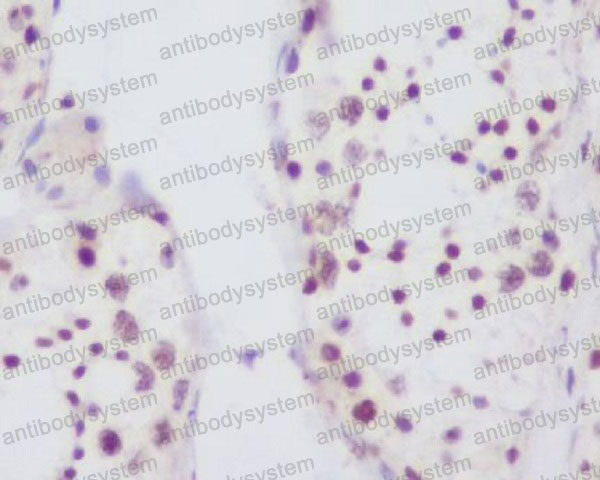 Валидация AntibodySystem RHD50101