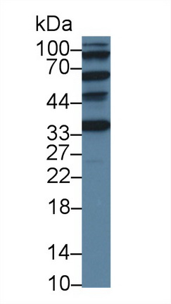 12608