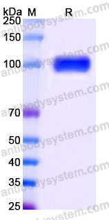 EHH06102, SDS-PAGE