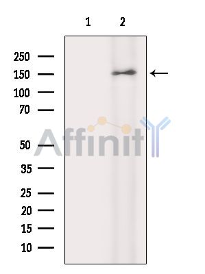Валидация Affinity DF14998 - 11202