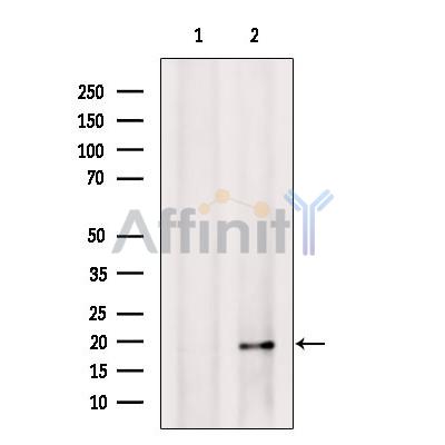 Валидация Affinity DF2407 - 13006