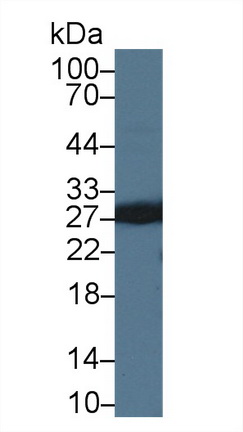 57321