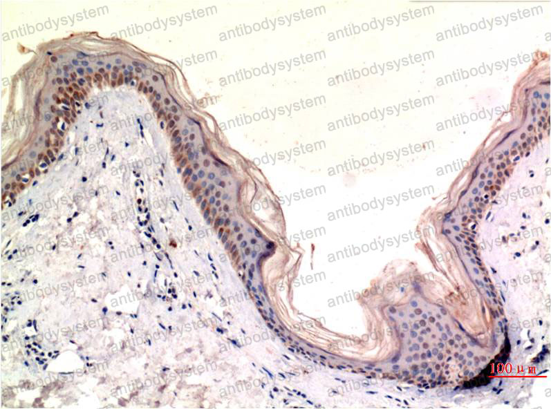 Валидация AntibodySystem RHJ23605